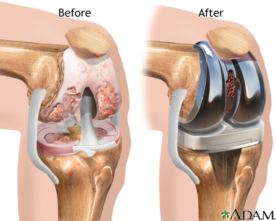 This is what they did to my knee